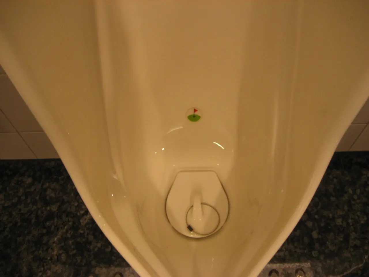 Prostate Cancer Progression: Degrees, Risks, Signs, and Therapies